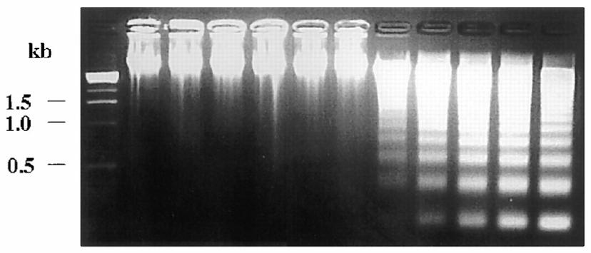 Fragmentace genomické DNA Internukleosomální fragmenty