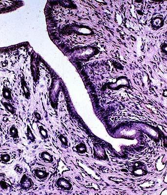 Uterus Endometrium 2 Jednovrstevný