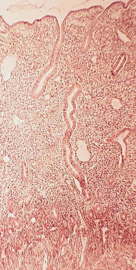 Endometrium Proliferační fáze