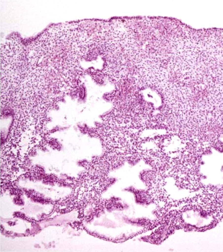 Endometrium Menstruační fáze dutina dělohy myometrium odpadající