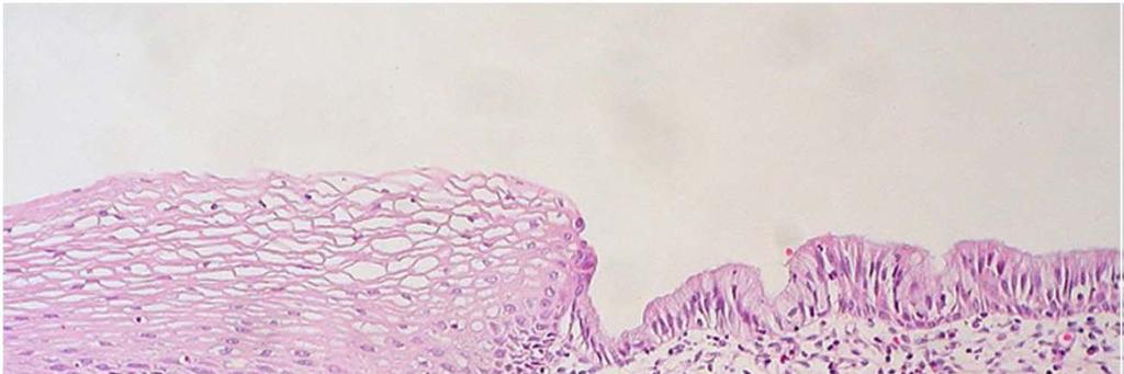 Cervix + Orificium externum uteri délka 2-3 cm