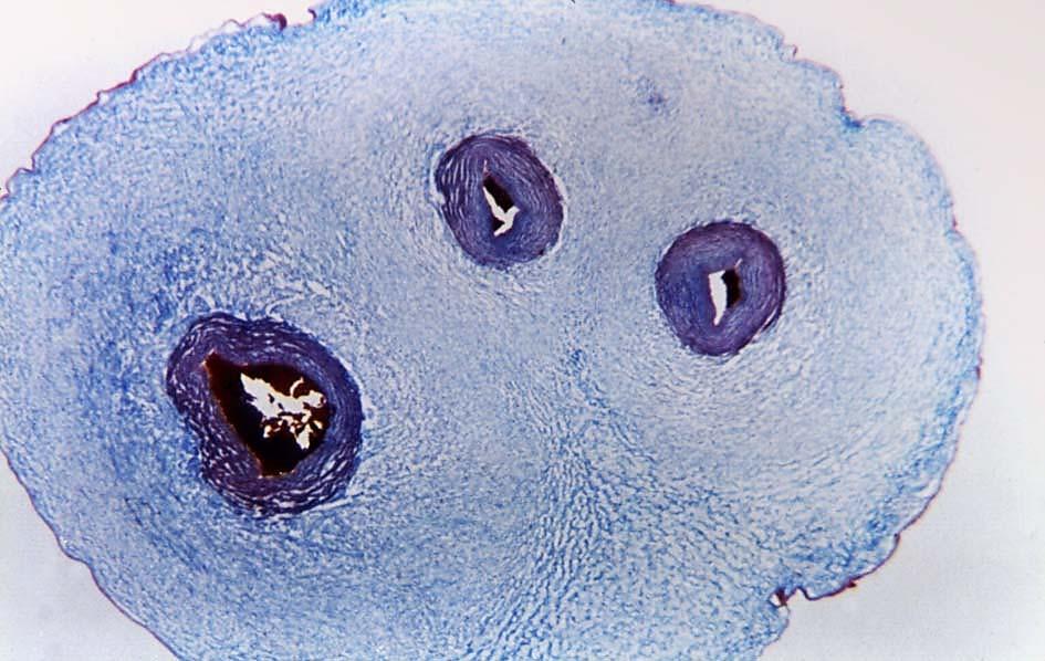 Pupečník spojuje fetus s placentou délka cca 55-60 cm Whartonův rosol