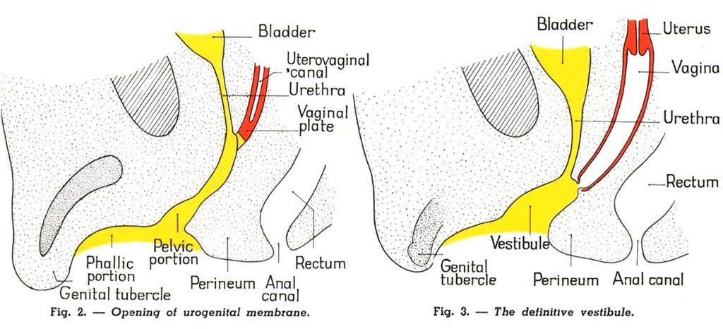 vestibula = vzniká ze sinus urogenitalis