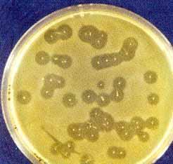 Fox et al., 2004 Mikroorganismy uplatňující se při zrání sýrů Bakterie: Streptococcus sp. Lactococcus sp.