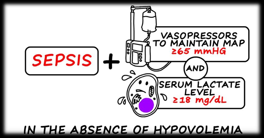 Septický šok klinická kritéria Sepse + hypotenze vyžadující