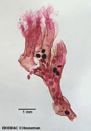 (Kmen) Bryozoa (=