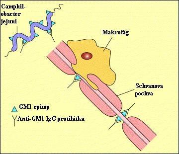 Obrázek č. 2 Patogeneze GBS zapříčiněná protilátkami anti-gm1 IgG následkem infekce Camphilobacterem jejuni (Yuki, 2001) 2.