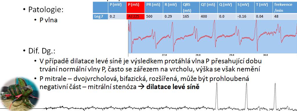 Samice leguána zeleného (Iguana iguana), 8,5 roku 3) Porucha v QRS KOMPLEXU často jediným zástupcem pouze