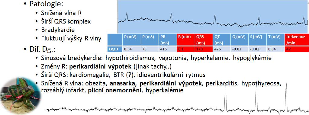 mononukleárů a heterofilů, v srdečních dutinách a v oblasti prostorů mezi myokardiálními