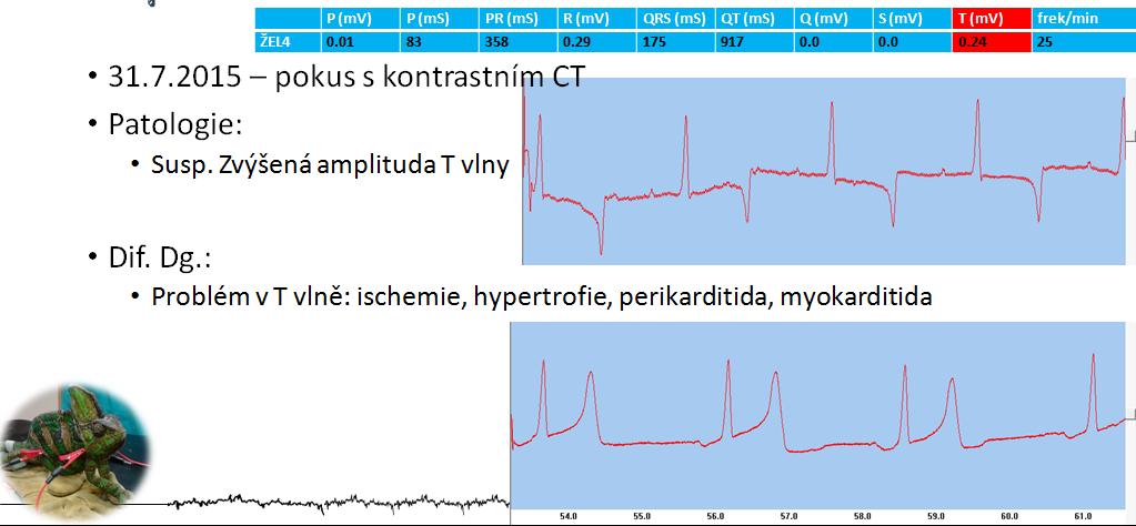 Problém v QT INTERVALU Obvykle to není jediný nález