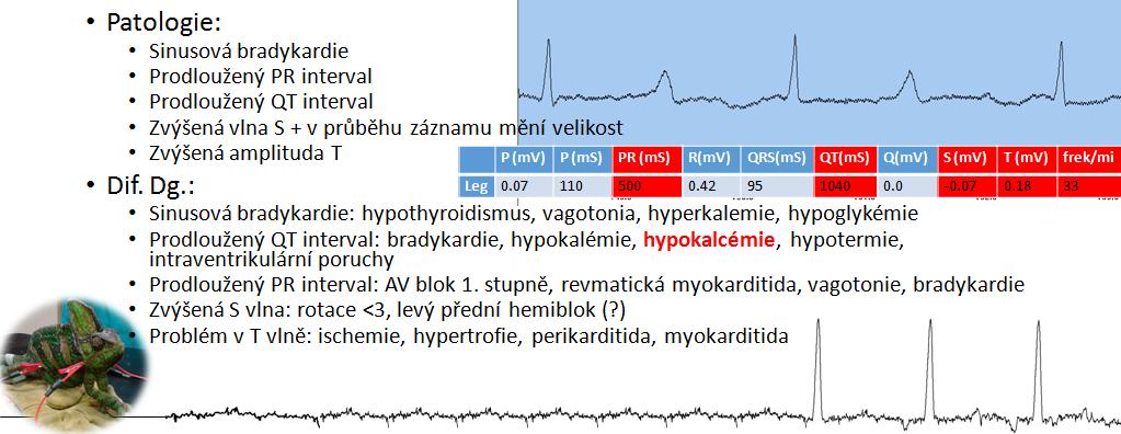 HYPOKALCEMIE 43