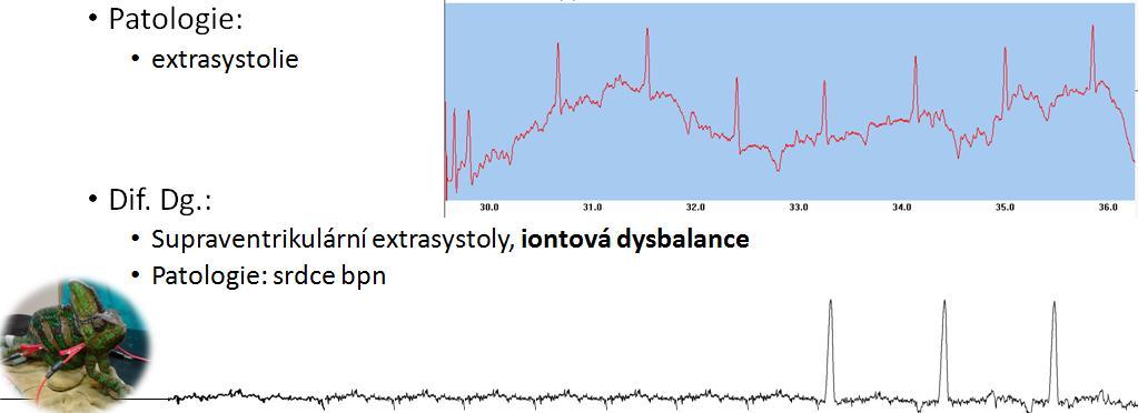 valvulární endokarditida Arytmie u ptáků podle nálezů na jednotlivých vlnách, intervalech a segmentech (podle Ritchie a