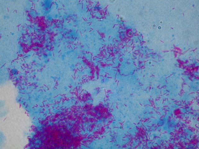 Mycobacterium tuberculosis