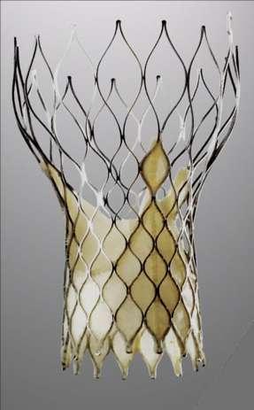 CoreValve, Irving, CA, USA samoexpandibilná perikaridalna prasačia chlopňa veľkkosti 22 a 26 mm stent je dlhý 50 mm vtoková časť slúži na elimináciu kalcifikácii v