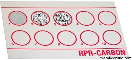 Precipitace: reakce RRR, RPR, VDRL (2)