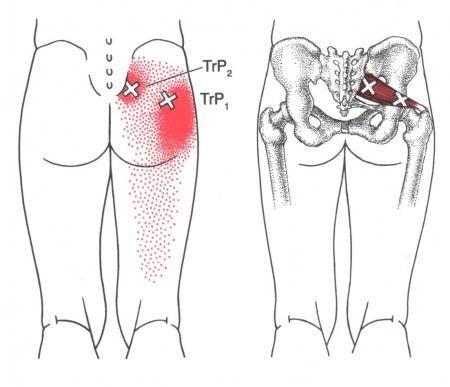 M. Piriformis +