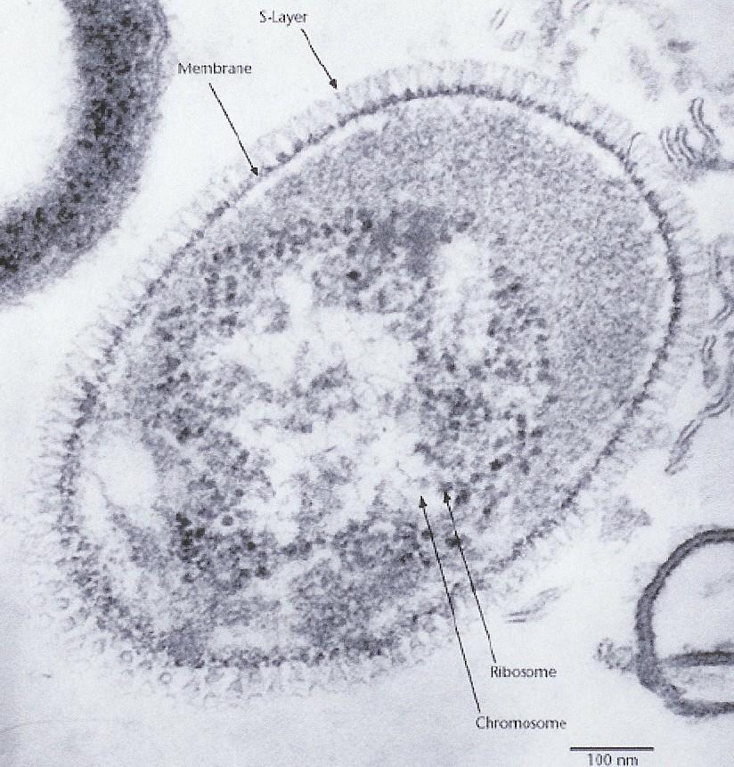Buněčná stěna Pseudopeptidoglykan (Methanobacteriales) Někdy S-vrstva (proteiny)