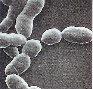 Tvorba metanu u člověka Methanobrevibacter smithii Metanogenní bakterie jsou u většiny lidí součástí normální mikroflóry tlustého střeva Dominantním metanogenem u člověka je Methanobrevibacter