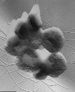 Doména Archaea Povrch buňky a cytoplazma 1μm Kmen Crenarchaeota Třída Thermoprotei Řád Desulfurococcales Čeleď