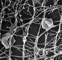 Doména Archaea Kmen Crenarchaeota Třída Thermoprotei Řád Desulfurococcales Čeleď Pyrodictiaceae Rod Pyrodictium buňky nepravidelného diskovitého tvaru