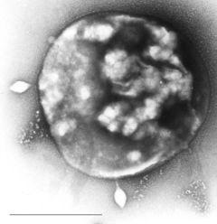 Doména Archaea Kolonie Sulfolobus Yellowstone Buňka Sulfolobus infikovaná temperovaným