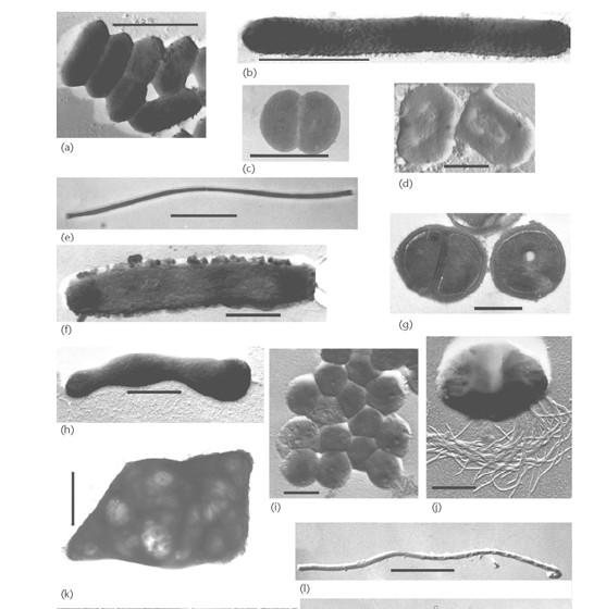 Morfologie buněk Archaea a/ Methanobacterium b/ Methanosphaera c/ Methanoplanus d/