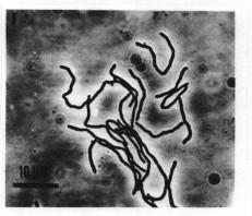 Doména Archaea Inumofluorescence (4000x) Kmen Euryarcheota Třída Methanobacteria Řád Methanobacteriale Čeleď Methanobacteriaceae Rod Methanobacterium Buňky jsou