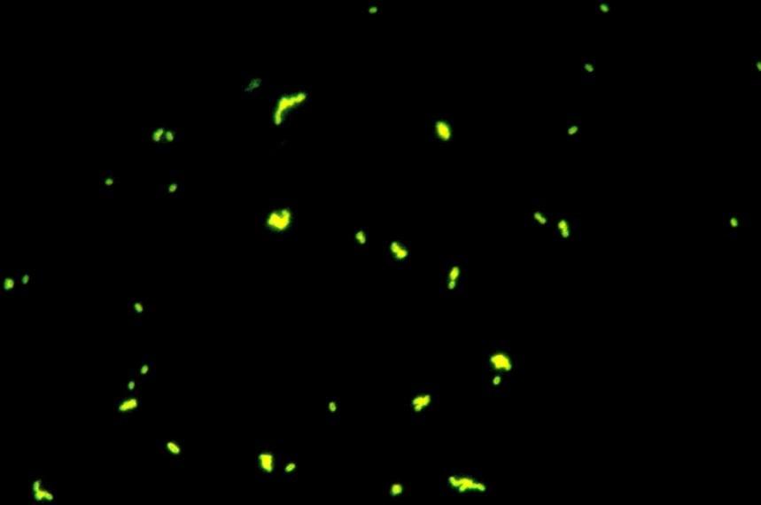 Doména Archaea Inumofluorescence (4000x) Kmen Euryarcheota Třída Methanobacteria Řád Methanobacteriale Čeleď Methanobacteriaceae Rod Methanobrevibacter Buňky jsou grampozitivní