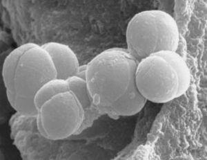 Doména Archaea Kmen Euryarcheota Třída Methanobacteria Řád Methanobacteriale Čeleď Methanobacteriaceae Rod Methanosphaera Buňky jsou grampozitivní, sférické, po dvou, v tetrádách nebo shlucích,