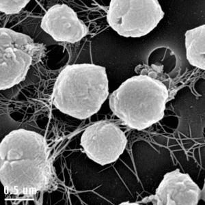 Doména Archaea Methanocaldococcus jannaschii White smokers 2600m Kmen Euryarcheota Třída Methanococci Řád