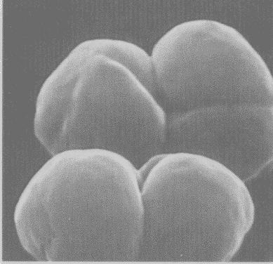 Doména Archaea Kmen Euryarcheota Třída Methanomicrobia Řád Methanosarcinales Čeleď Methanosarcinaceae Rod Methanosarcina Buňky