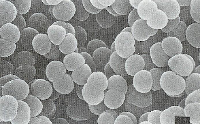 Doména Archaea Model chloridové pumpy Kmen Euryarcheota Třída Halobacteria Řád