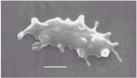Doména Archaea Kmen Euryarcheota Třída Thermoplasmata Řád Thermoplasmatales Čeleď Thermoplasmataceae Rod Thermoplasma Gram negativní buňky jsou