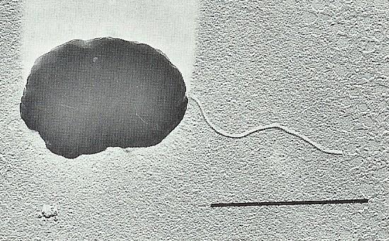 buňky nemají buněčnou stěnu a jsou obklopeny jednoduchou trojvrstevnou membranou (lipopolysacharidy, glykoproteiny, větvené diglycerol