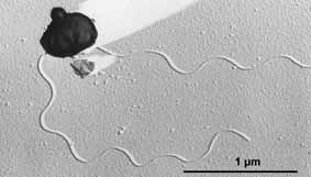 Doména Archaea biofilm Kmen Euryarcheota Třída Archeoglobi Řád Archeoglobales Čeleď Archeoglobaceae Rod Archeoglobus Buňky