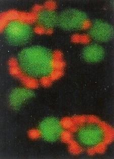Doména Archaea Ignicoccus Nanoarcheum Nový kmen Nanoarcheota Nanoarcheum je rod velmi malých kokoidních buněk, které žijí jako