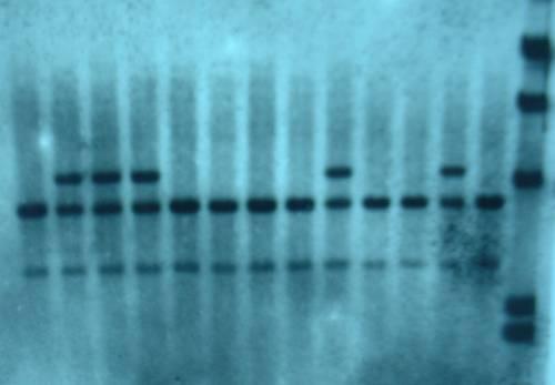 Schéma RFLP markerů - Izolace DNA - Restrikční analýza - Elektroforetická