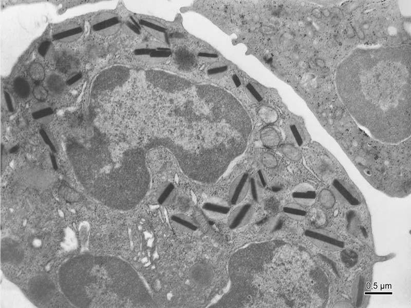 Eosinofilní