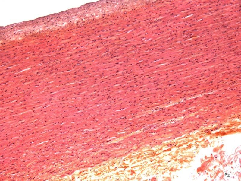 Velká tepna: A B Aorta A. Tunica interna (až 100 μm): 1. endotel 2. subendotel B. Tunica media (nejširší): 1.