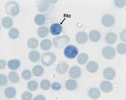 Retikulocyty Nezralé ery, v periferní krvi 0,5 1,5 % Obsahují zbytky organel /polyribosomy, mitochondrie =