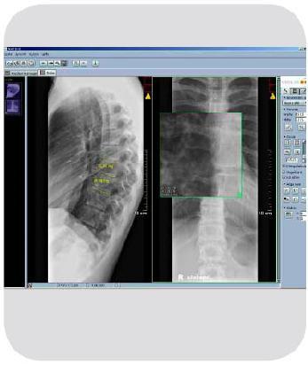 JiveX diagnostický prohlížeč Diagnostický prohlížeč je součást systému JiveX určená pro popis snímků rentgenologem.