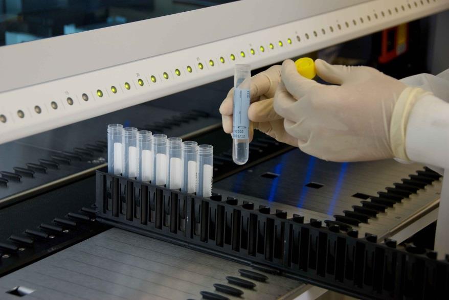 Loading of primary/secondary tubes onto platform Reduce manual labour and human error cobas 4800 System