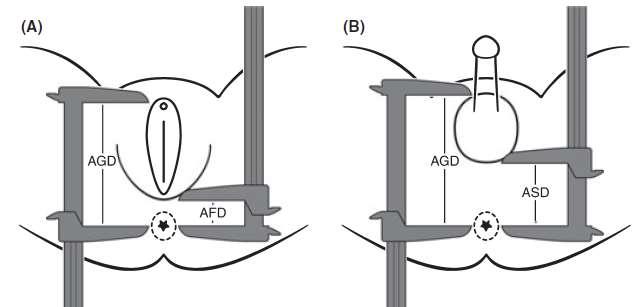 newborns An-ogenital distance ano-scrotal distance ano-fourchette distance diagrams.