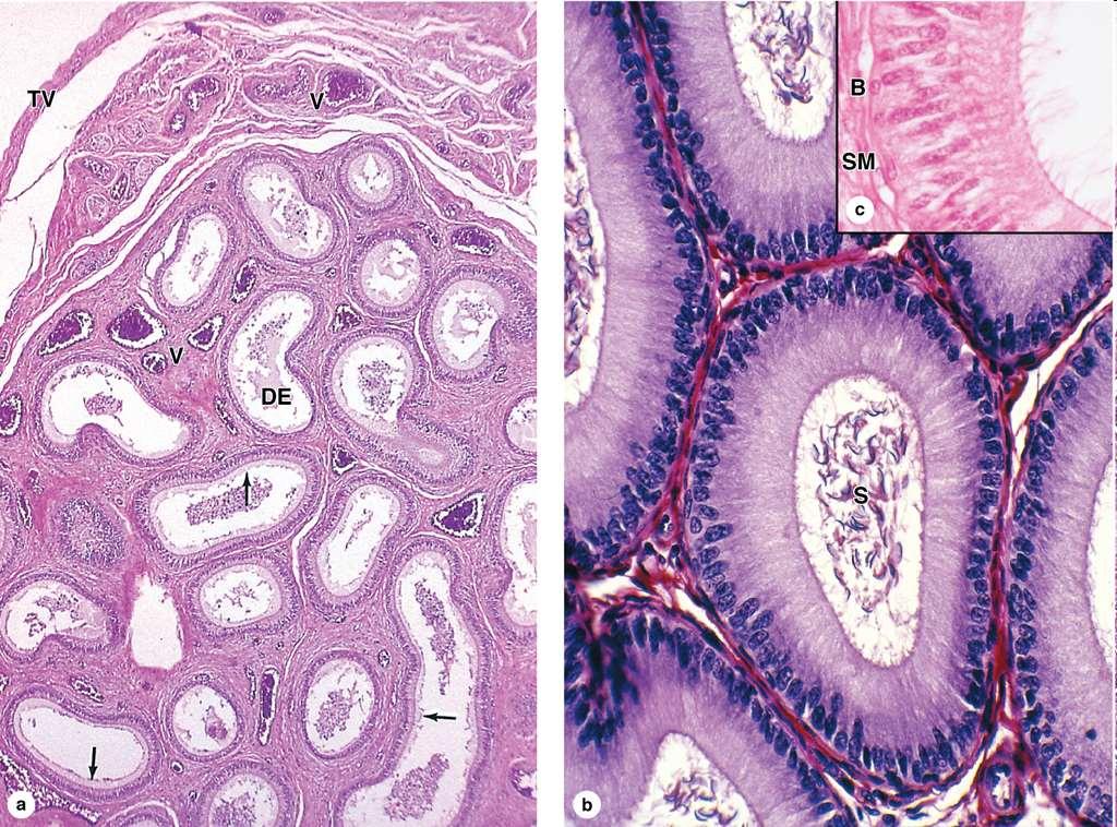 Epididymis: 6 m stočených