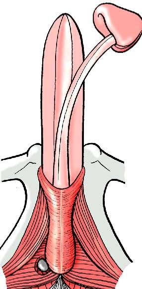 Corpus cavernosum penis, crus, corpus