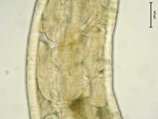 Characteristic spermatheca (receptaculum seminis) of the potworm Fridericia perrieri.