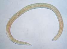 da), zatímco P. similis a P. steineri jsou více luční druhy (Brzeski 1998). Podobná situace je i u čeledi Criconematidae (řád Tylenchida).