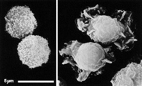 protoporfyrin IX s navázaným iontem Fe 2+ nezbytným pro vazbu molekuly kyslíku. Množství hemoglobinu u mužů je 135-170 g/l, u žen 120-158 g/l krve [2].
