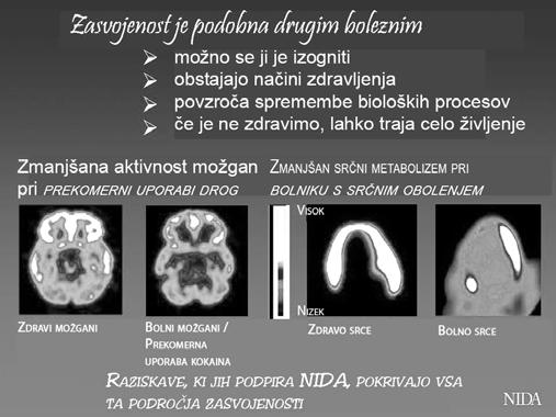 take droge je kokain, ki je za zmanjšanje stresa»droga prve izbire«, nekakšno preventivno sredstvo proti prekomernemu stresu.