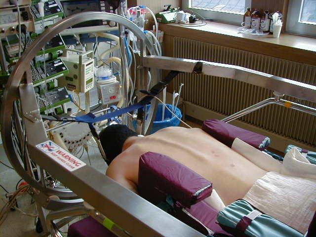 Pronační poloha Dorsální recruitment Méně vzestup afterload pro PK (Vieillard-Baron A: Intensive Care Med 2005) Zlepšení clearance dých cest není problém u prim. pneumonitis, redukce inc.vap (?